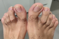podologo-badalona podologia-clinica 2