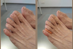 podologo-badalona podologia-clinica 4